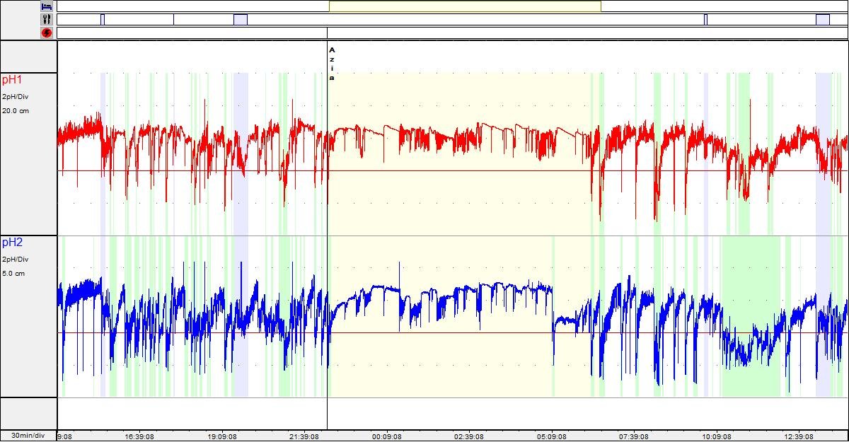pHmetria Esofágica 24h